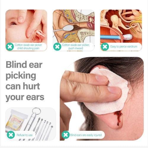 Digital Otoscope WiFi Earpick Camera Visual Endoscope, Ear Scope with 19 Ear Cleaner Tools for iOS, Android - Toytexx Digital Otoscope WiFi Earpick Camera Visual Endoscope, Ear Scope with 19 Ear Cleaner Tools for iOS, Android - Toytexx